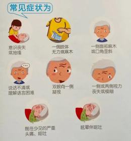 識別卒中?珍愛生命